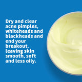 De La Cruz Sulfur Ointment - Cystic Acne Treatment for Face and Body - Daily 10 Min Spot Treatment Mask - Safe and Effective Game Changing Hormonal Acne Treatment that Clears Up Pimples - 2.6 OZ