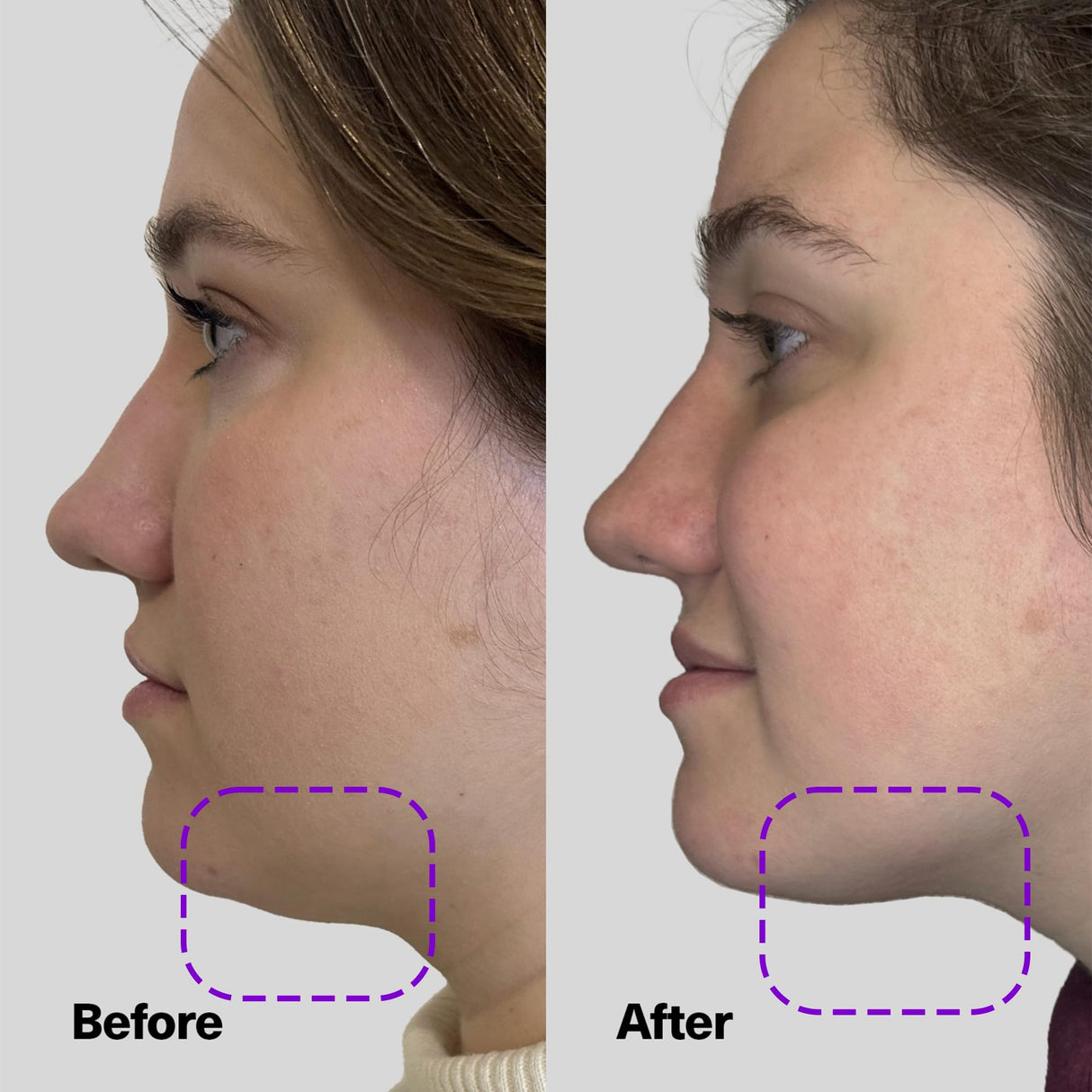 SickScience ShapeShift Jaw Defining Serum for Double Chin, Face & Neck Tightening for Sagging Skin, Anti Aging Moisturizer for Wrinkles & Crepey Skin, Neck Lifting Serum for Women & Men, 1.7 oz