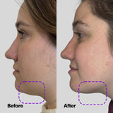 SickScience ShapeShift Jaw Defining Serum for Double Chin, Face & Neck Tightening for Sagging Skin, Anti Aging Moisturizer for Wrinkles & Crepey Skin, Neck Lifting Serum for Women & Men, 1.7 oz