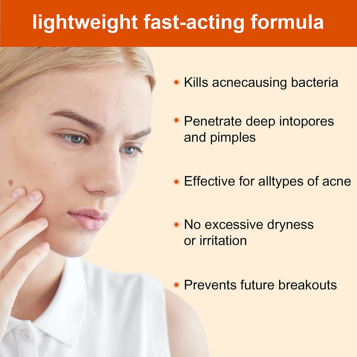 Acne Treatment Cream for Face & Body - Anti-acne Moisturizer for Teens & Adults - Spot Treatment for Breakouts & Blemishes - 30g