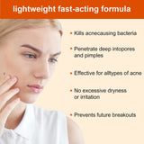 Acne Treatment Cream for Face & Body - Anti-acne Moisturizer for Teens & Adults - Spot Treatment for Breakouts & Blemishes - 30g