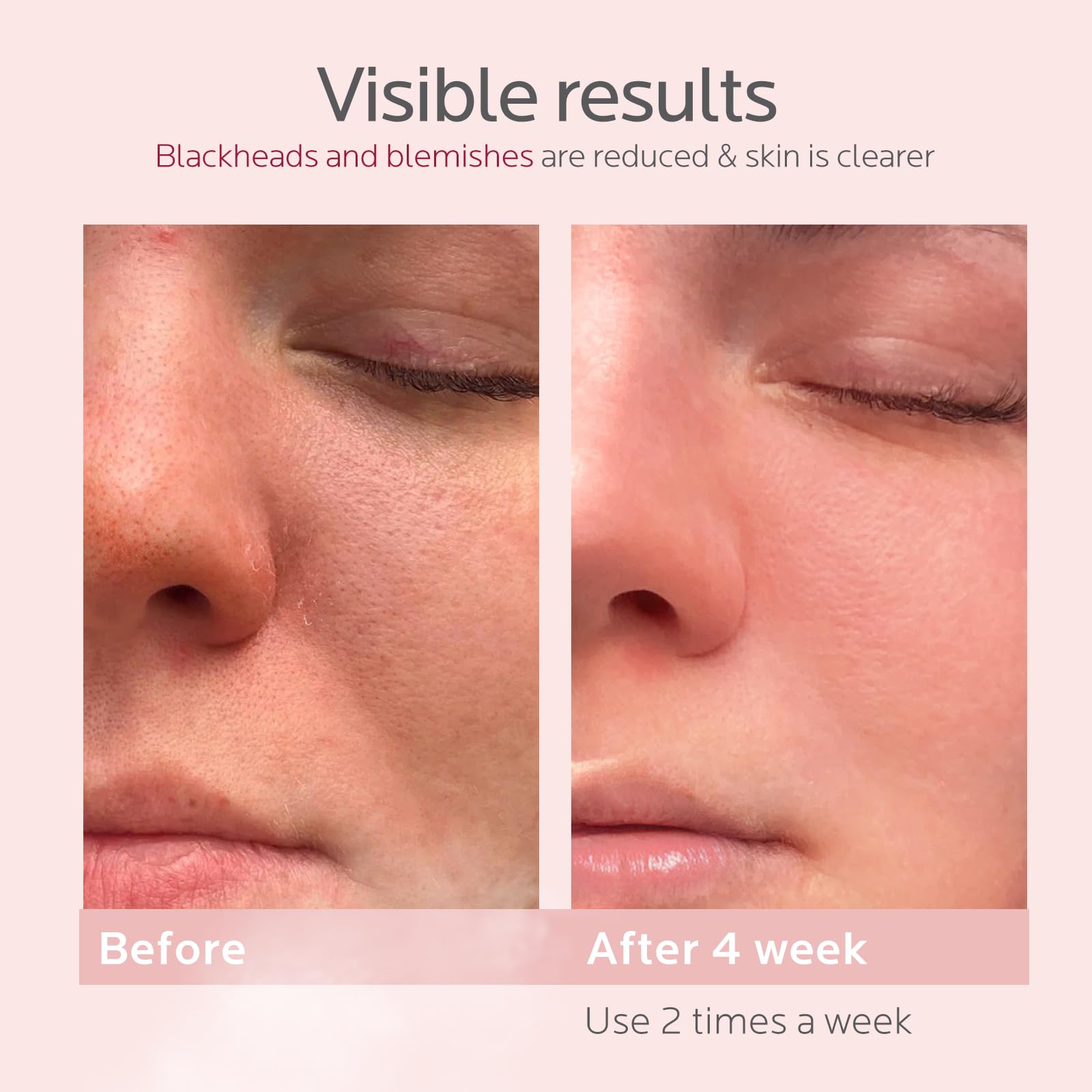 Colorfarm Facial Steamer - Thumbnail 2