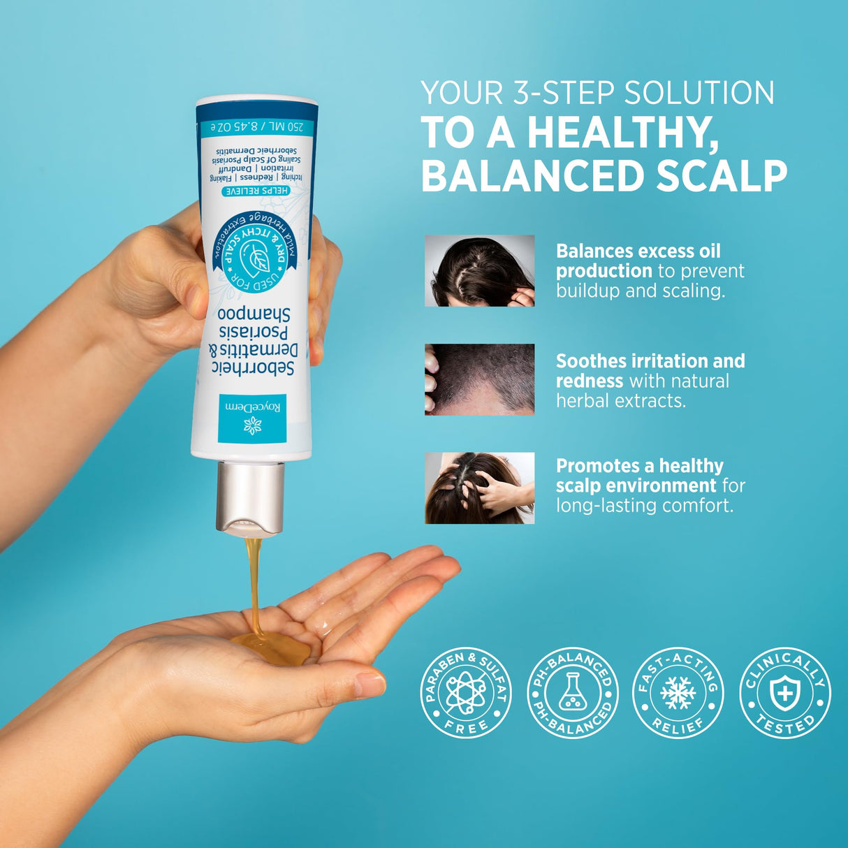 Roycederm Seborrheic Dermatitis & Psoriasis Shampoo and Conditioner Set - Effective Scalp Treatment for Folliculitis, Psoriasis, Dandruff, Dry Itchy Scalp - Soothing, Moisturizing Herbal Formula