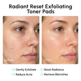 MAREE Glycolic Acid Toner Pads - Face Pads for Exfoliating Peel Zero Pore
