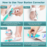 HUQKIYA Bunion Corrector for Women & Men, Orthopedic Bunion Splint with Toe Separator Adjustable Toe Straightener Suitable for Left/Right Feet Hallux Valgus Relief (White 1Pcs)