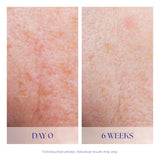 iS CLINICAL Active Serum; Face Serum, Anti-Aging, Helps skin with acne and pigmentation, 0.5 Fl Oz