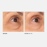 U Beauty The RETURN Eye Concentrate - Anti-Aging Eye Cream with Peptides and Antioxidants for Brighter and Tighter Under Eyes, Reduce Fine Lines, Puffiness & Dark Circles - 0.5 fl oz