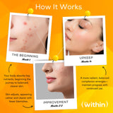 Clear Within Clear Skin Vitamin - with 10 Natural Ingredients for Acne-Free, Clearer Complexion, Oil Control & Blemish Minimization. Supports Skin Clarity | Non-Synthetic 60 Cap/Bottle