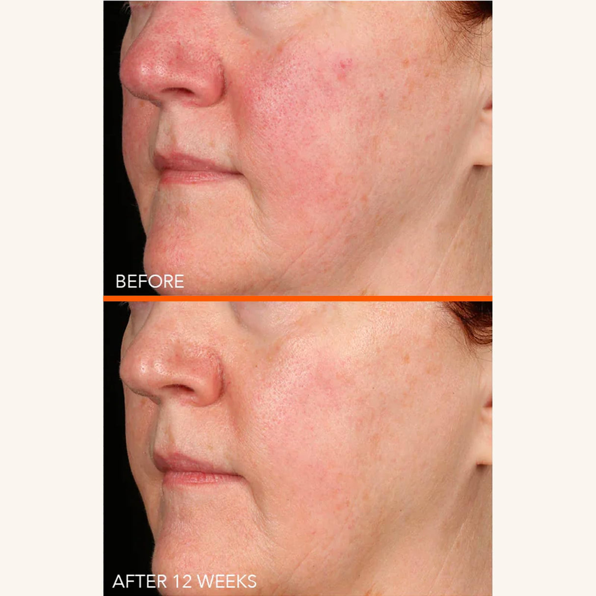 Dr Dennis Gross Vitamin C Lactic 15% Firm & Brighten Serum: Visibly Improve Signs of Aging, 1 oz