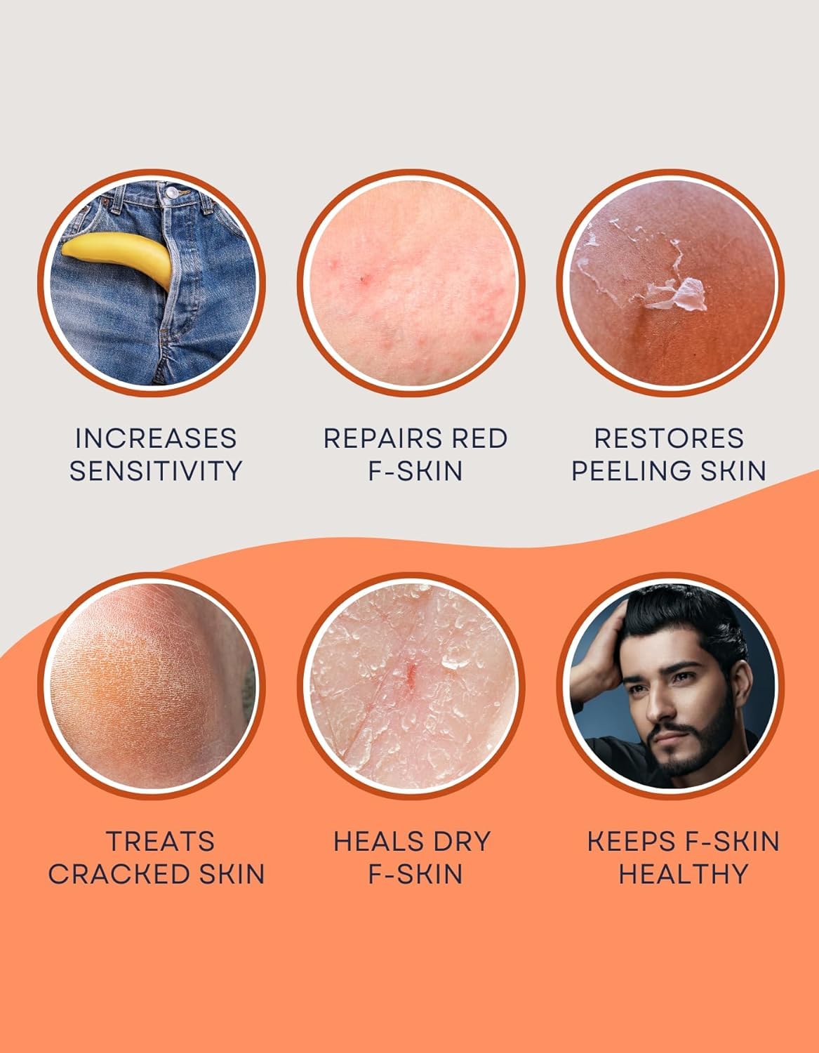 CAUSEHUMAN Penile heal cream for phimosis, redness, dryness, and scarring of skin | Prevents Irritation | Phimosis Cream | Restores and Moisturizes skin | 100 ml (3.38 fl oz) | 60 days supply