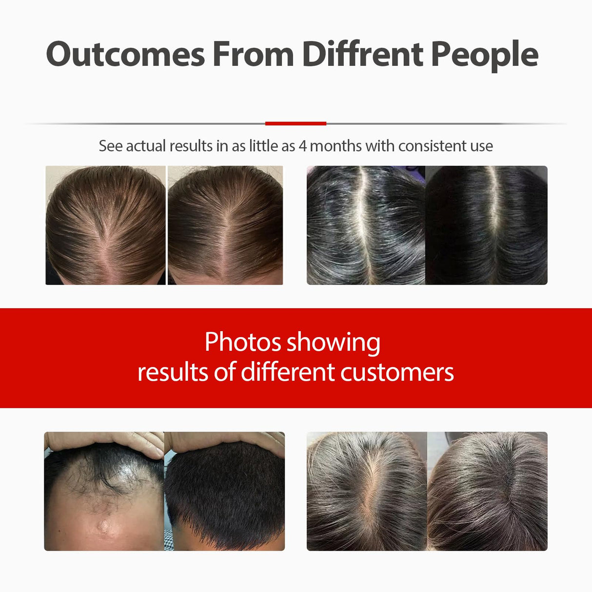 Laser Hair Growth Cap, Red Light Therapy for Hair Regrowth, Laser Therapy Cap for Hair Loss, Hair Loss Treatments Hat for Men & Women