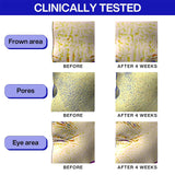 IOPE Retinol Super Bounce Serum - Daily Korean Skincare for Anti-Aging, Reduction in Fine Lines & Wrinkles, Beginner Friendly, Gentle Nourishment for Sensitive Skin, 1.69 Fl Oz.