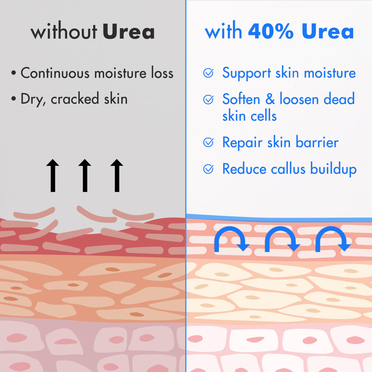 Ebanel Urea Cream 40% plus Salicylic Acid 2%, Foot Cream for Dry Cracked Heels Feet Knees Elbows Hands, Foot Dead Skin Cuticle Callus Remover Toenail Softener, Keratolytic Skin Barrier Repair