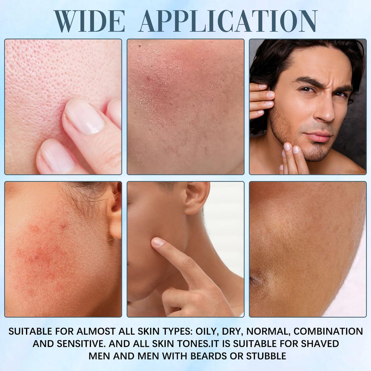 Organic Acne & Redness Killer, Acne and Redness Relief Balm, Organic Acne Remove Set, Acne killer Skin Care Set (3pcs)