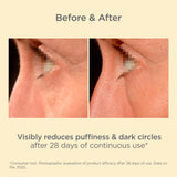 ISDIN Isdinceutics K-Ox Eyes - Rich Vitamin K Oxide Eye Cream for Dark Circles and Under-Eye Rejuvenation, 0.5 OZ