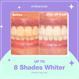 Smileactives Teeth Whitening Kit - 1oz (Pack of 3) - Features Clinical-Grade Hydrogen Peroxide for Long Lasting White Teeth, Simply add to Toothpaste to Permanently Remove Coffee Stains & More!