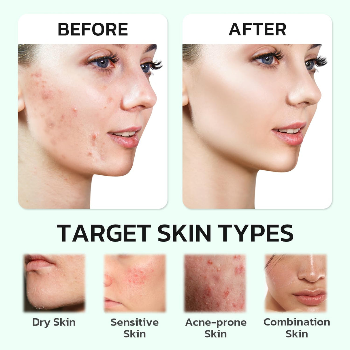 GNJOY Centella Moisturizer Phytocin Cream Soothing Centella Asiatica Moisturizer Face Hydration Barrier Repair Calming PDRN Cream for Acne Prone, Sensitive Skin, Ceramide, B5, Salmon (30ml)