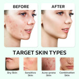 GNJOY Centella Moisturizer Phytocin Cream Soothing Centella Asiatica Moisturizer Face Hydration Barrier Repair Calming PDRN Cream for Acne Prone, Sensitive Skin, Ceramide, B5, Salmon (30ml)