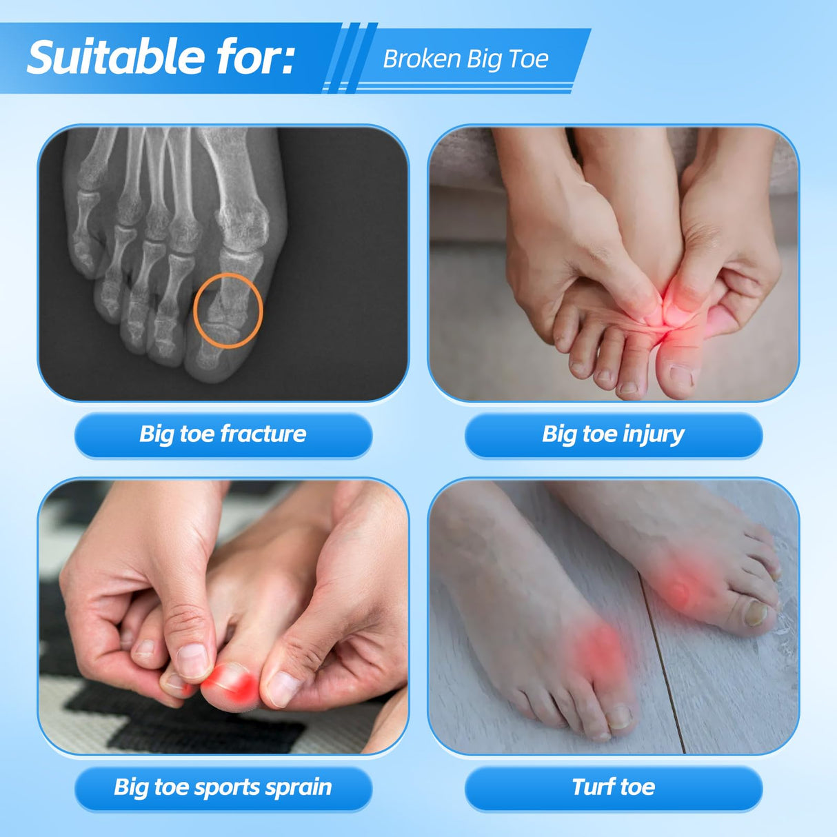 Chonario Big Toe Splint for Broken Toe, Fracture Big Toe Protectors Support for Sprains, Arthritis, Turf Toe, Women & Men, Big Toe Brace with 2 Detachable Metal Plates - Right