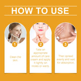 4 Pack Bee Venom Wart and Tag Remover, Bee Venom Mole and Wart Treatment Cream, Tag Recede Bee Venom for Skin