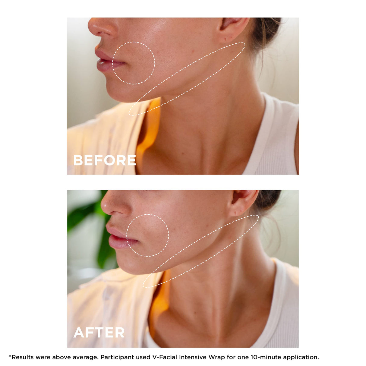 Clarins V-Facial Intensive Wrap Face Mask | Award-Winning Facial Contouring Mask | Visibly Reduces Puffiness and Swelling Caused by Stress,Heat and Hormonal Changes | Promotes Even Skin Tone | 2.5 Oz