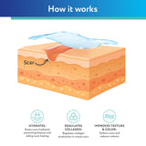 ScarAway Silicone Scar Gel, Helps Improve Size, Color & Texture of Hypertrophic & Keloid Scars from Injury, Burns & Surgery, Water Resistant, 20g (0.7 Oz)