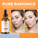 Lupure Professional Vitamin C Face Serum 20%, Anti Aging Facial Super Vit C Serum with Ascorbic Acid Hyaluronic Acid & Vitamin E for Dark Spots, Skin Care, Christmas Gift & Stocking | 1 Fl. Oz