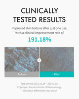 REJURAN® Moisture Treatment Toner, c-PDRN® - Hydrating Facial Toner for Enhanced Skin Barrier Strength, Soothing, and Moisture Retention with PDRx, Korean Skin Care (5.07 fl oz)