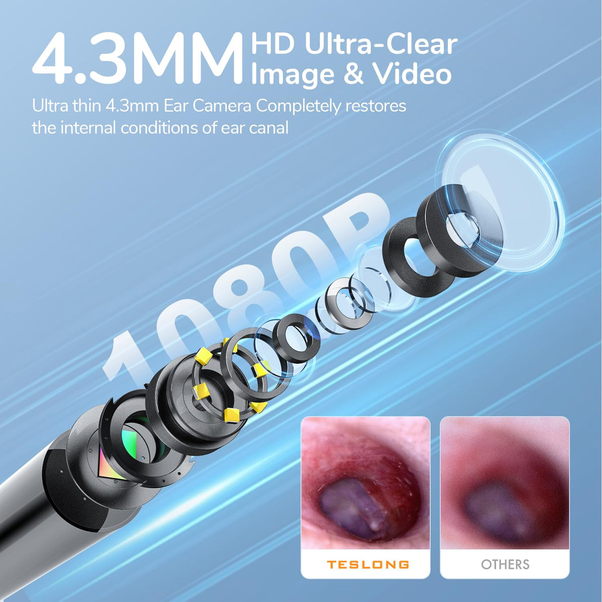Teslong Digital Otoscope, 1080p HD Ear Camera with Ear Wax Removal Tools, Video Ear Scope Otoscope with Light, Compatible with iPhone15, iPad, Android Phone, USB, Ear Picks, Waterproof