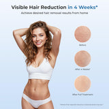 Aopvui Laser Hair Removal for Women and Men, IPL Permanent At Home Hair Removal Device with 5°C Ice Cooling Function, 999,990+ Flashes Painless Hair Removal for Face,Armpits, Legs, Arms, Bikini Line