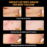 MONIER Tallow and Honey Balm for Face, Beef Tallow for Skin, Moisturizer with 100% Organic Grass-Fed Beef Tallow & Raw Wild Honey - Natural Formula for Dry & Sensitive Skin (Unscented)