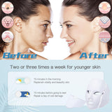 HXDZFX LED FACIAL LIGHT THERAPY MASK-Led Face Mask Light Therapy, 7 Led Light Therapy Facial Skin Care Mask - Blue & Red Light for Acne Photon Mask - Skin Care Mask for Face and Neck.White