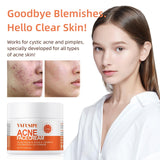 Acne Treatment for Face for Hormonal Cystic Stubborn Acne Cream for Sensitive Skin Teens Adults Women Men Spot Pimple Butt Control Rapid Clearing Breakout Overnight Face Blemish Treatment Moisturizer