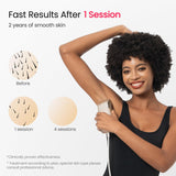 Dual Lights 100W, Quadruple-Pulse IPL Laser Hair Removal, Comfort 16.6 cm² Sapphire Ice-Cooling 35°F, PHR Mode for Stubborn Hair, Effective, Hair Removal Device for Women and Men (Light Champagne)