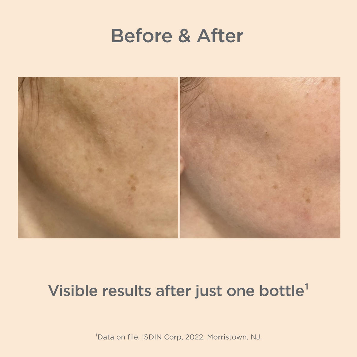 Isdinceutics Melaclear Advanced - Dark Spot Corrector for Face with Niacinamide 1.7 FL OZ (50 ml).