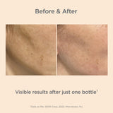 Isdinceutics Melaclear Advanced - Dark Spot Corrector for Face with Niacinamide 1.7 FL OZ (50 ml).