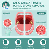 ALITAKE Electronic Vacuum Tonsil Stone Remover - Tonsil Stone Removal Kit with Built-in LED Light & 3 Suction Mode - Fight Bad Breath Oral Irrigator & 5X Magnifying Mirror for Tonsil Stone Removal - Green