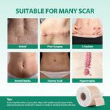 Medical Grade Silicone Scar Sheets (1.6” x 120” Roll - 3M), Professional Silicone Scar Tape, Reusable Silicone Scar Strips, Scar Remove Treatment for Acne Scars C-Section & Keloid Surgery