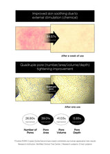 [FINDIVE OFFICIAL] PDRN CICA Exosome Serum, PDRN (Sodium DNA) 1%, Cica Exosome 1,000ppm, Marin Collagen, Soothes, Regenerates Skin, 1.69fl.oz