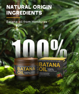 Qytin Batana Oil for Hair Growth, 100% Natural Pure Batana Oil Paste from Dr. Sebi Honduras, Prevents Hair Loss, Enhances Thickness, Organic Raw Batana Hair Mask for Women & Men (4.05 Oz)