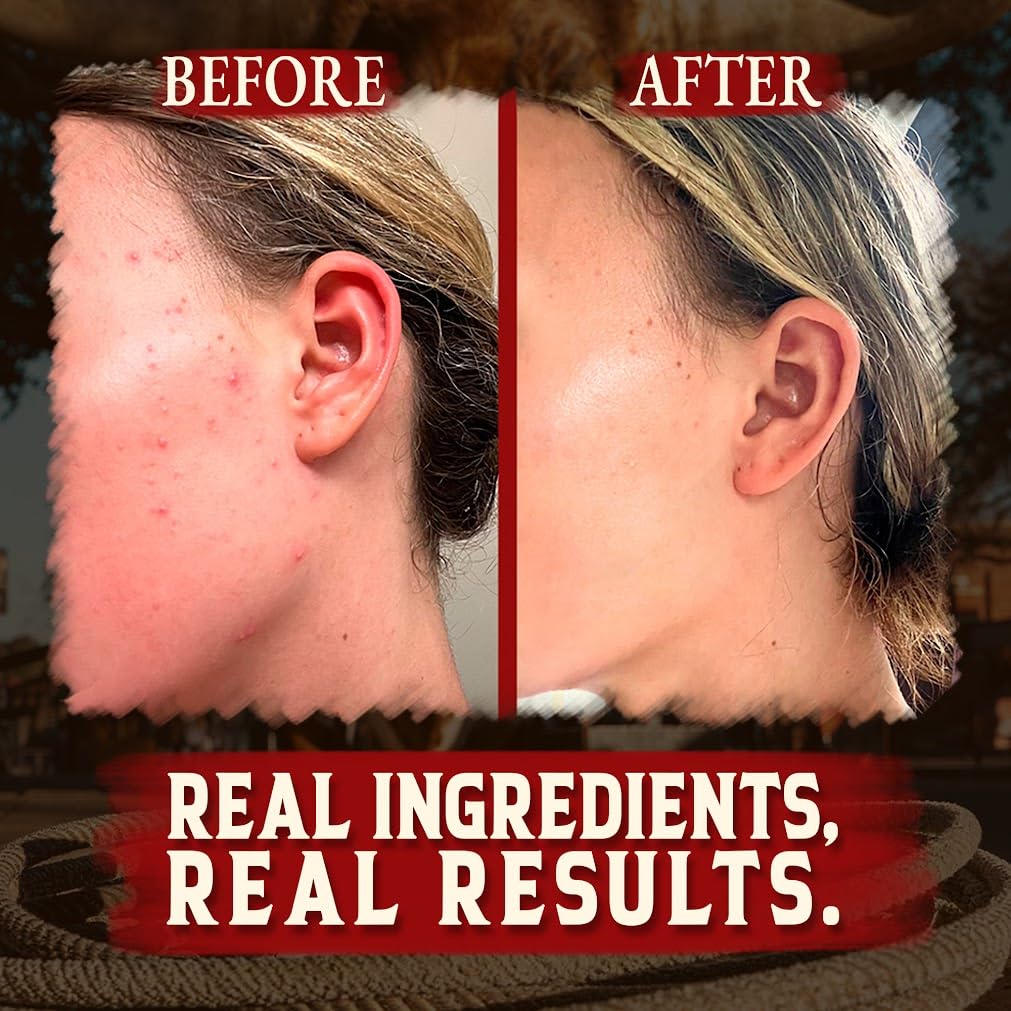 Wrath & Remedy Handmade Whipped Organic Beef Tallow for Skin - 4 OZ (3-Pack) — Grass Fed Beef Tallow Moisturizer and Honey Balm for Silky, Sensitive-Skin, Eczema, Rosacea - Free of Harsh Chemicals