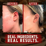 Wrath & Remedy Handmade Whipped Organic Beef Tallow for Skin - 4 OZ (3-Pack) — Grass Fed Beef Tallow Moisturizer and Honey Balm for Silky, Sensitive-Skin, Eczema, Rosacea - Free of Harsh Chemicals
