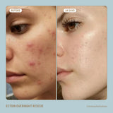 BIOSSANCE Squalane + Ectoin Overnight Rescue, hydrating, Firming and Smoothing Skin Care Treatment, 1.6oz