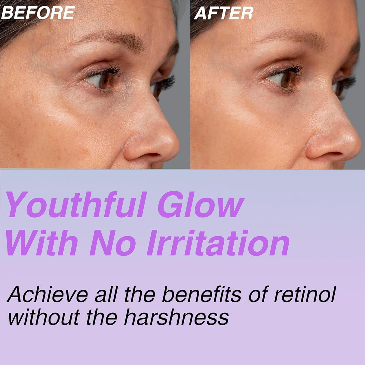 CELDYQUE 100% Pure Volufiline & Bakuchiol 30,000 ppm Concentrate Serum - Skin Firming Solution High Potency Retinol Alternative | Anti-Wrinkle Boosts Collagen for Aging Sagging Mature Skin