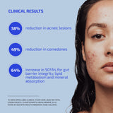 Codex Labs Shaant Clear Skin Supplement – 60 Vegan Capsules | Acne Probiotics with 9-Strain Blend, Green Tea EGCG & Guggul – Daily Support for Acne-Prone Skin & Clear Complexion