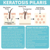 KP Bump Eraser Body Set | Keratosis Pilaris Treatment | Keratosis Pilaris Lotion | Exfoliating Body Scrub | Ingrown Hair Treatment | Bundle Set for Bump, Strawberry Legs, Redness, Dry & Flakey Skin