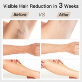 Laser Hair Removal, BoSidin IPL Hair Removal with Painless Ice-Cooling, 2-in-1 Face SR Rejuvenation, 6+1 Modes, 6 Levels Hair Removal for Women Permanent, Laser Hair Removal Kit with Shaver, Goggles