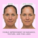 Drunk Elephant T.L.C. Sukari Babyfacial - 50 ml/1.69 fl oz - Exfoliating Face Mask - Clean Clinical Skincare - Cruelty-Free - Dermatologist-Tested - Free of Essential Oils, Silicones, and Fragrance