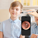 Teslong Digital Otoscope, 1080p HD Ear Camera with Ear Wax Removal Tools, Video Ear Scope Otoscope with Light, Compatible with iPhone15, iPad, Android Phone, USB, Ear Picks, Waterproof