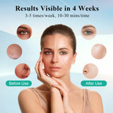 biuufish Red Light Therapy for Face, 7＋1 Colors LED Face Mask Light Therapy with 850NM Near-infrared, Portable Rechargeable Red Light Therapy Mask Skin Care Device at Home and Travel for Anti-Aging